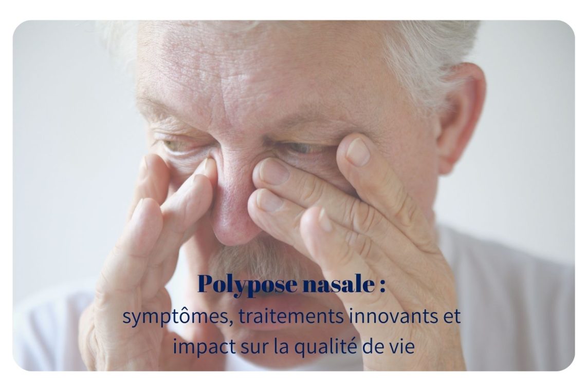 Polypose nasale : comprendre, reconnaître et traiter cette inflammation du nez